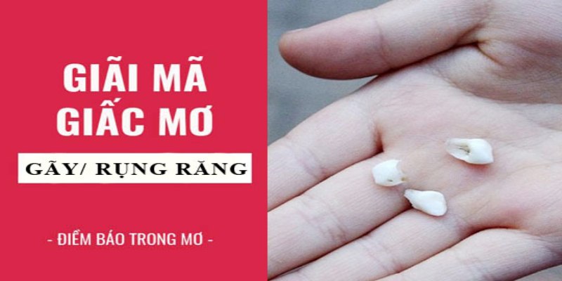 Nằm Mơ Thấy Rụng Răng Đánh Số Mấy Chắc Thắng Lô Đề  